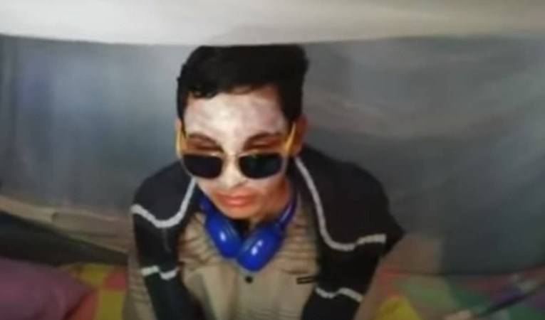 Venezuelska policija ispalila 50 gumenih metaka u lice tinejdžera, oslijepila ga